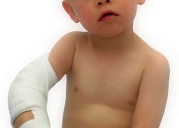 Xương trẻ gãy rất mau lành