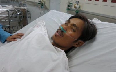 Viêm xương vì châm cứu