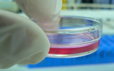 Dùng mô túi màng ối bảo vệ và nuôi giác mạc tổn thương