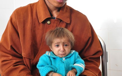 Bé 5 tuổi trông như trẻ sơ sinh