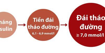 Xử trí tiền đái tháo đường