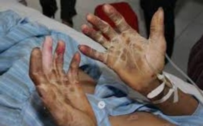 Điểm danh những trọng bệnh do ăn nội tạng động vật