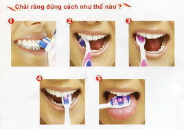 Bệnh do chải răng không đúng cách