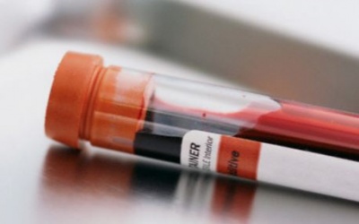 Áp dụng kỹ thuật phát hiện sớm mẫu máu có bệnh