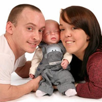 Chuyện kỳ diệu của chú bé 'lùn đôi'