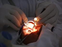 Bình Định: Mổ mắt miễn phí cho 100 bệnh nhân nghèo