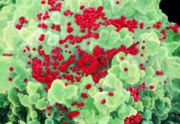 Ca nghi nhiễm HIV hiếm có giữa đôi đồng tính nữ