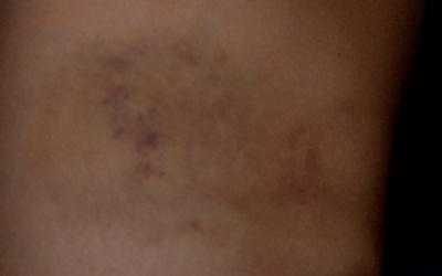 Học sinh lớp 2 không dám đến trường vì sợ... cô giáo đánh