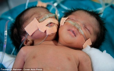 Ấn Độ: Hai bé sinh đôi chưa được gặp mẹ