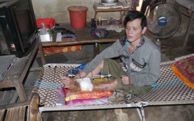 Suýt mất chân, tay bởi... bác sĩ