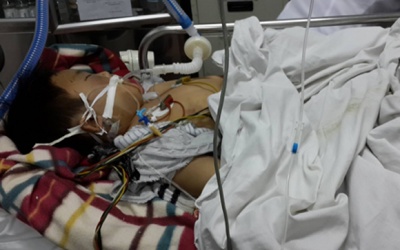 Vụ bố dùng điếu cày đánh chết con: Cháu Lộc đã  bị hành hung thế nào?