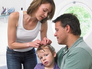 Thời hiện đại, vẫn khổ vì... chấy