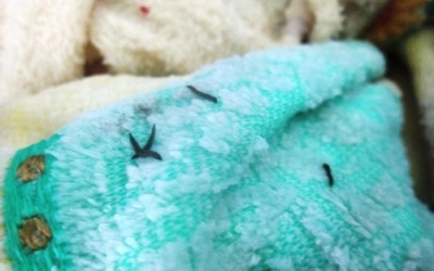 “Sinh vật lạ” trong khăn tắm là ấu trùng không gây hại