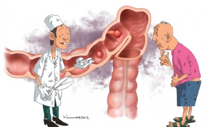 Chủ động ngừa ung thư đại trực tràng