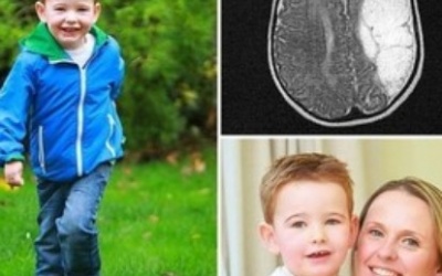 Sự sống kỳ diệu của em bé bị mất nửa não