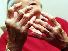 Thừa Thiên Huế: Thành lập Hội Thấp khớp học