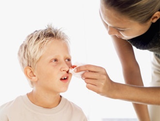 Trẻ chảy máu cam, đừng cuống