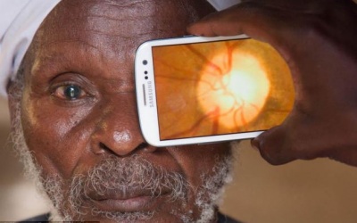 Giảm nguy cơ mù nhờ 'Túi bác sỹ nhãn khoa'