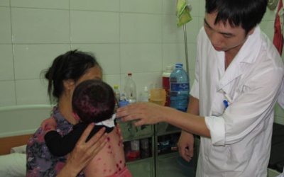 TP. HCM: Các bệnh do virus đang gia tăng