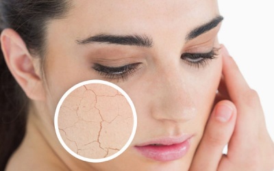 Da khô - Vì sao nên nỗi?