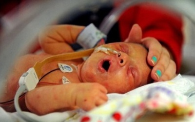 Bé gái sinh ra chỉ có... nửa trái tim