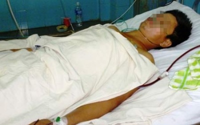 Con trai bị tâm thần dùng kéo đâm trúng tim cha