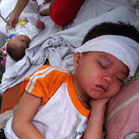 Hoang mang trước dịch sởi