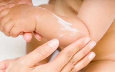 Không được tùy tiện dùng corticoid bôi da cho trẻ