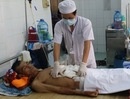 Cứu sống bệnh nhân bị phình động mạch chủ, ngưng tim