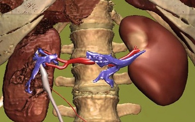 Thấy mặn trong miệng là bệnh gì?