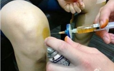 Tiêm corticoid vào khớp: Không được tùy tiện