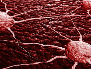 Nhật phát hiện loại enzim chặn di căn của tế bào ung thư