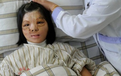 Những bộ phận cơ thể người từng được tái tạo