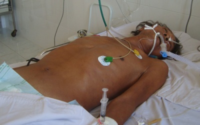 Nhậu nhộng ve sầu, 3 người nguy kịch