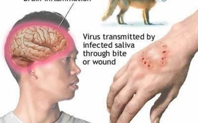 15 người tử vong do bệnh dại: Chưa có thuốc chữa khi phát bệnh