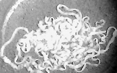 Ăn thế nào để tránh nhiễm sán?