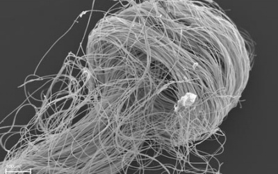 Tìm thấy tinh trùng hóa thạch cổ nhất thế giới