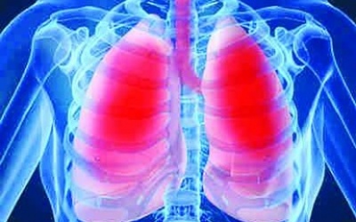 Nguy cơ viêm phổi tụ cầu sau mụn nhọt