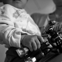 Bé 18 tháng bị quên nhiệt kế trong hậu môn