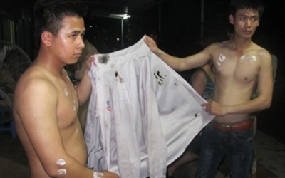 Hàng chục người bỏng nặng, áo cháy sém vì xe chở axit