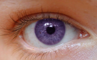 Màu mắt tiết lộ bệnh tật