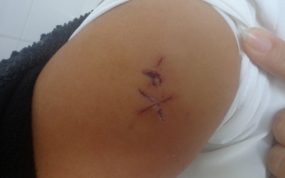 Sếp nữ dùng kéo đâm công nhân nhập viện