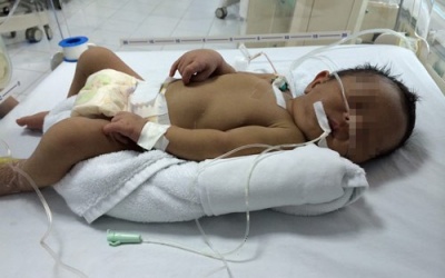 Bất đồng nhóm máu với mẹ, một trẻ sơ sinh suýt chết