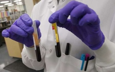 Thử máu tìm ký sinh trùng