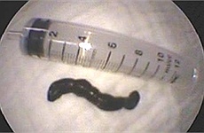 Đỉa bò ngoe nguẩy trong bim bim nghi của Trung Quốc?