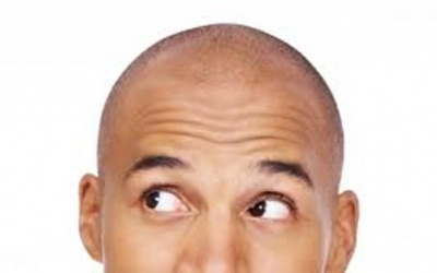 Bước tiến mới trong điều trị chứng vô mao