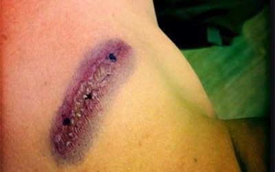 Kiến ba khoang 'tấn công' hàng loạt chung cư: 'Ngứa mà không dám gãi'