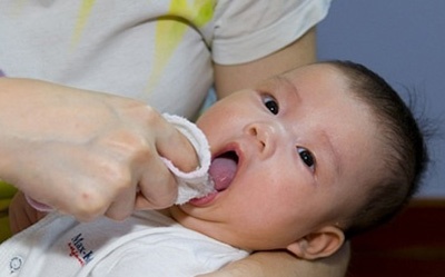 Các bệnh răng miệng phổ biến ở trẻ