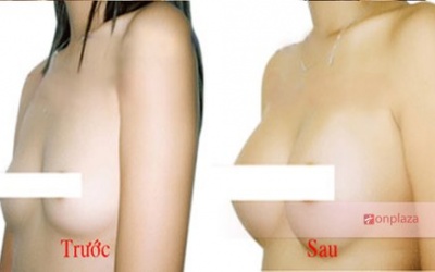 Miếng dán tan mỡ, nở ngực - dán cho... mất mạng