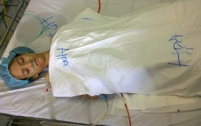 Cứu sống bé gái có khối u lạ nặng hơn 5kg